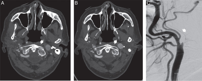 FIGURE 1