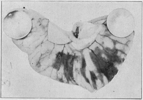 Fig. 11