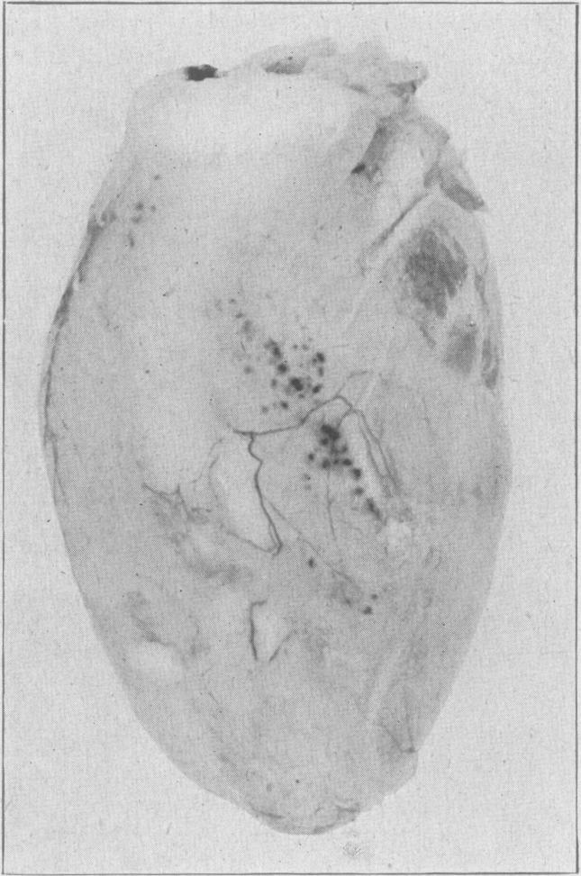 Fig. 10