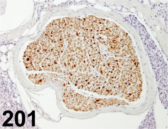 Fig.
201.