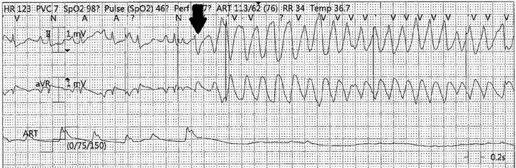 Figure 4