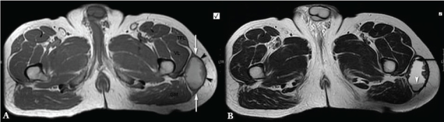 [Table/Fig-1a,b]: