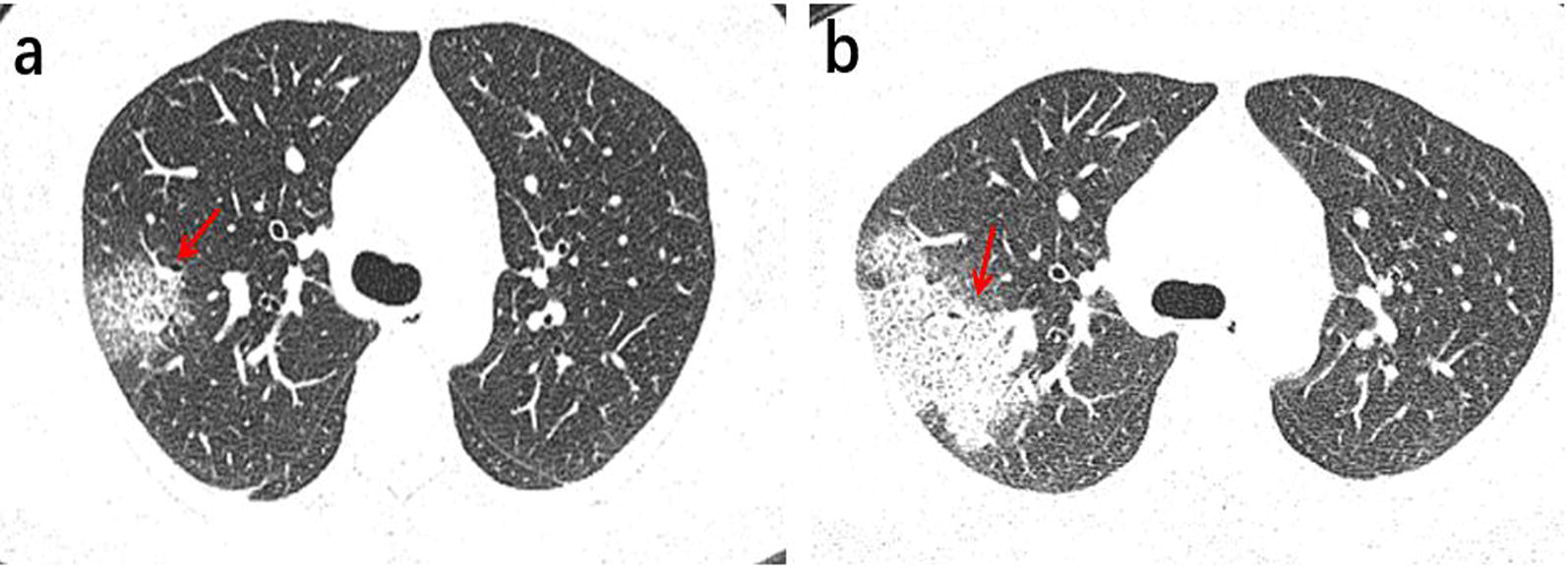 Fig. 4