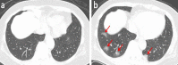 Fig. 5
