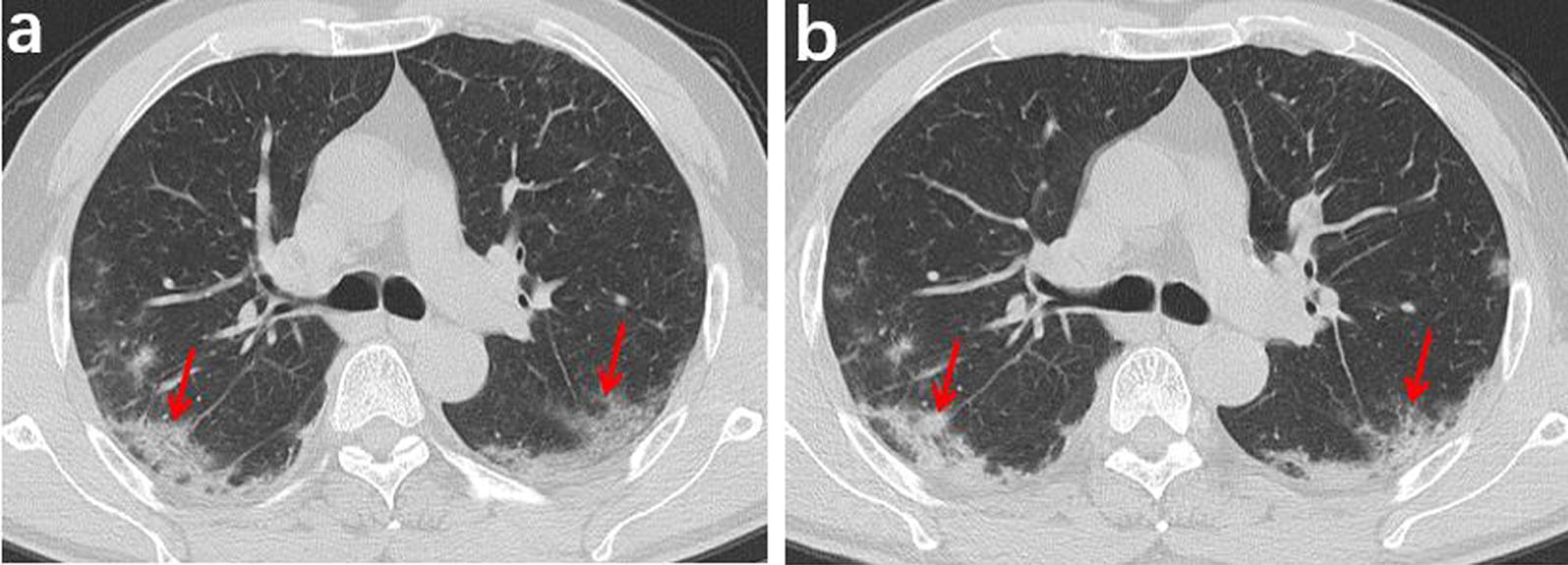 Fig. 3