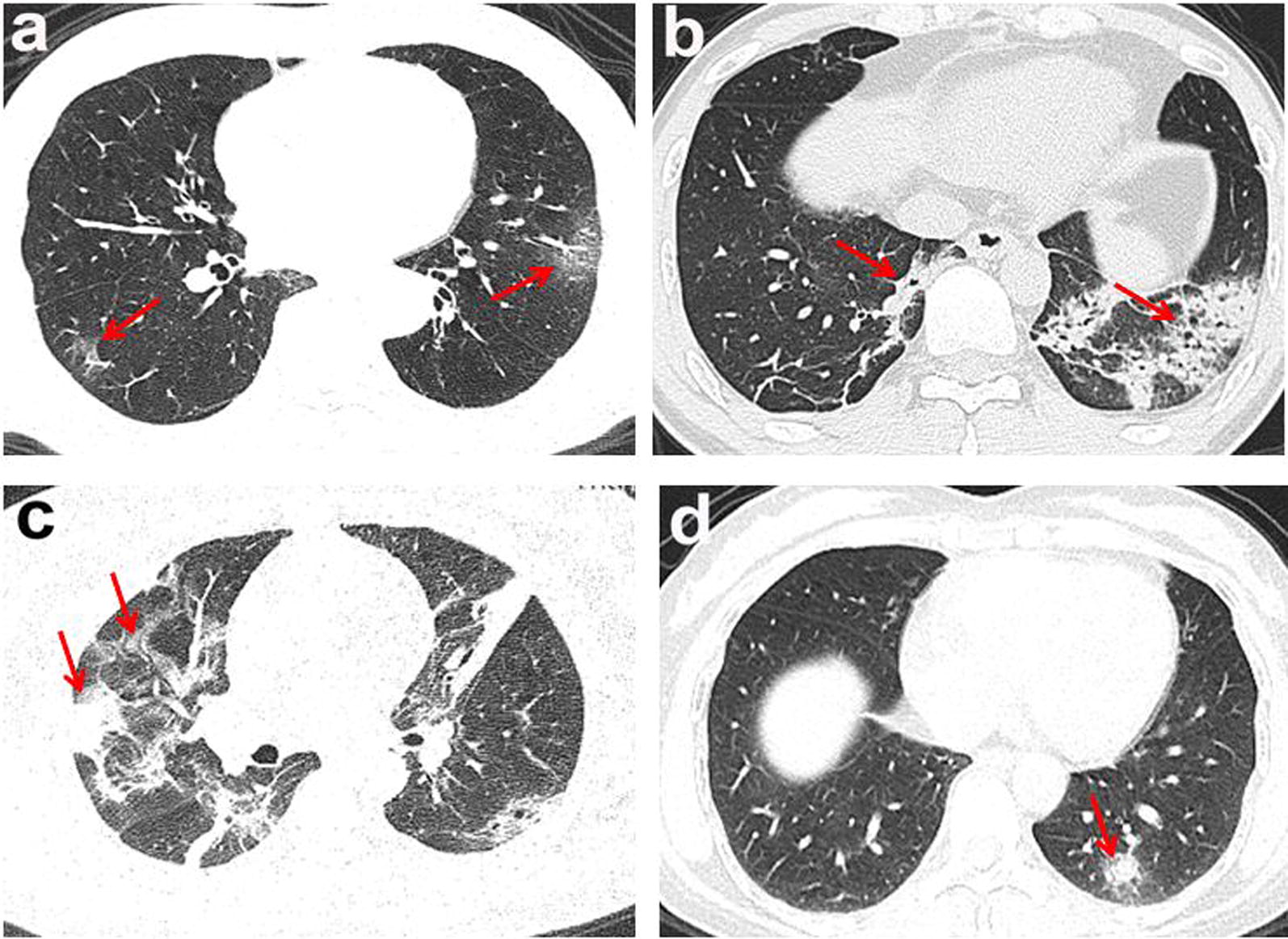 Fig. 1