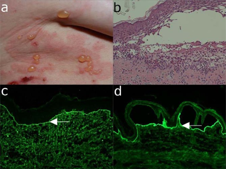 Fig. (13)