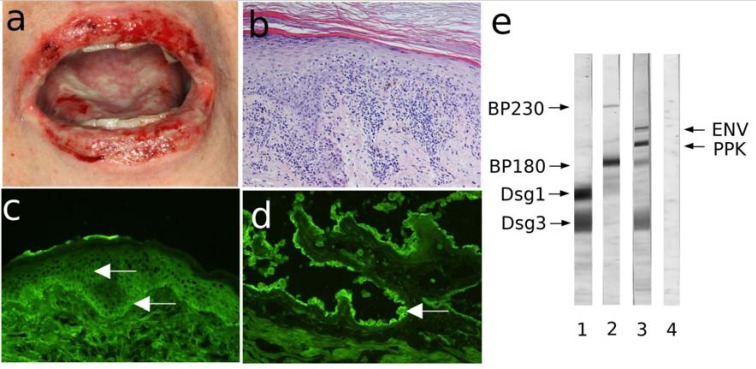 Fig. (5)