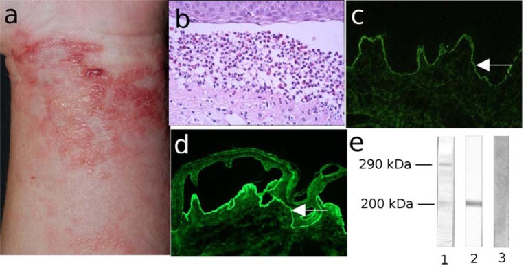 Fig. (12)