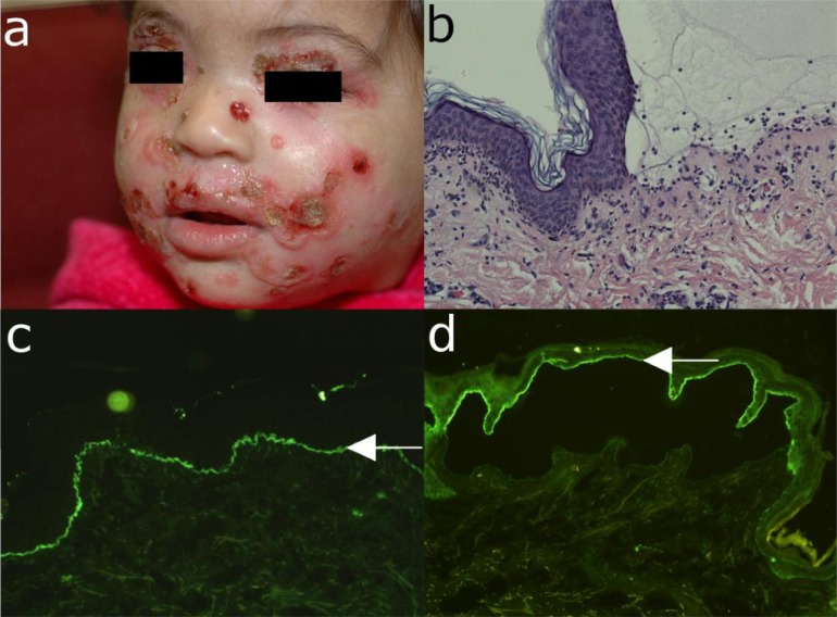 Fig. (10)