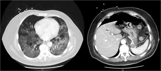 Fig. 2