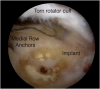 Fig 8