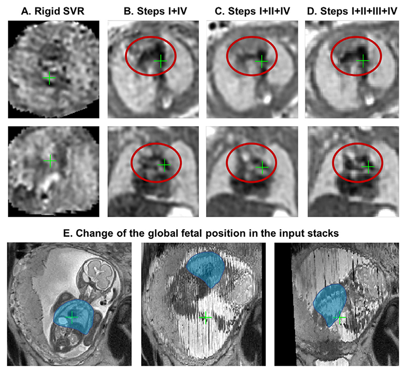 Fig. 15