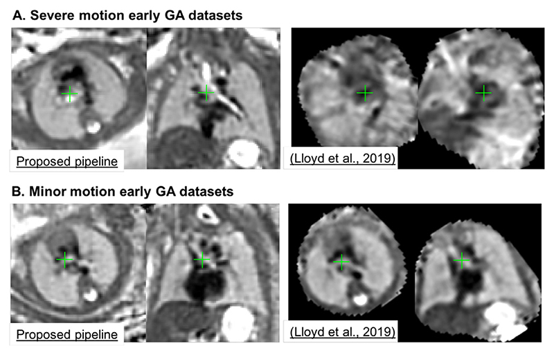 Fig. 19