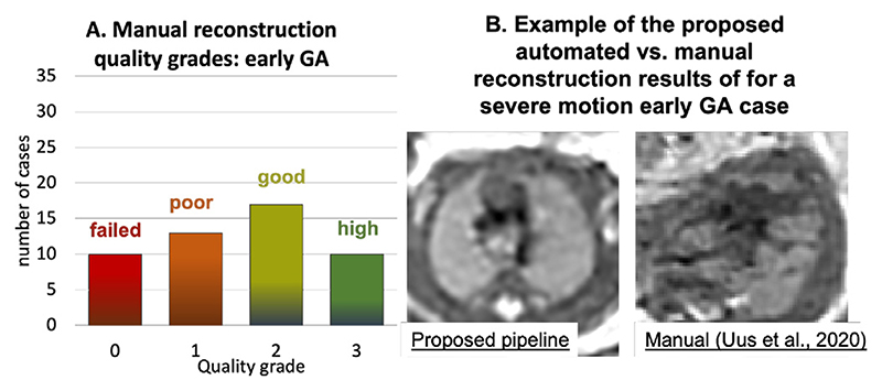 Fig. 18