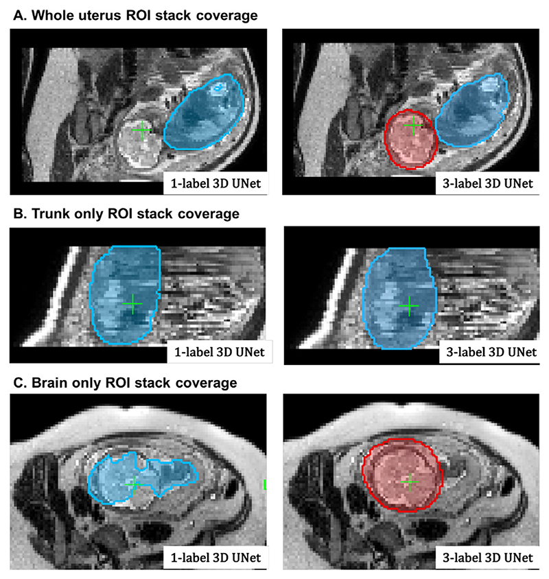 Fig. 11