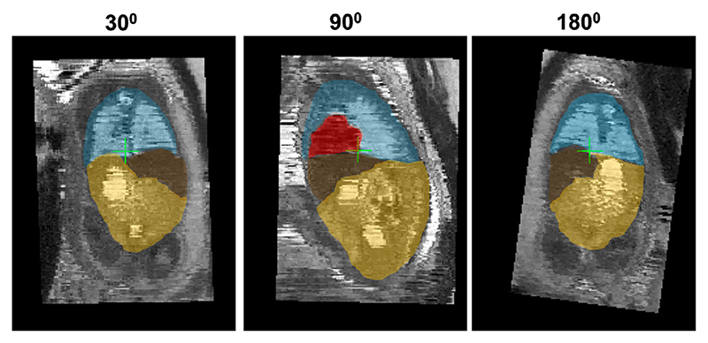 Fig. 13