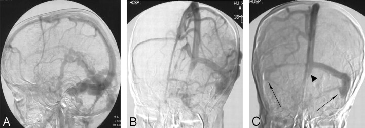 Fig 3.