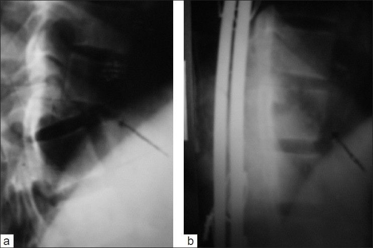 Figure 2: