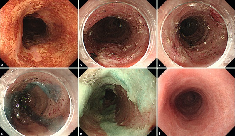 Fig. 2