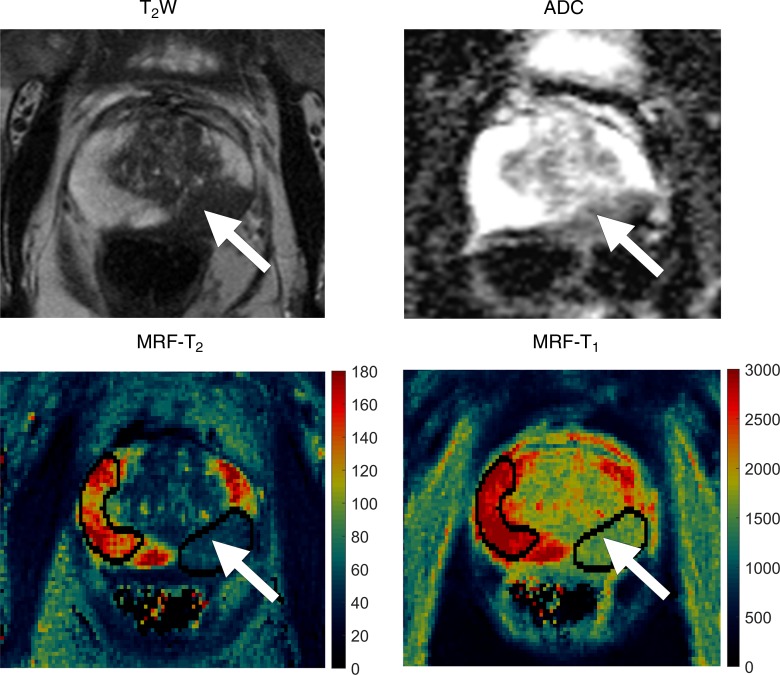 Figure 2a: