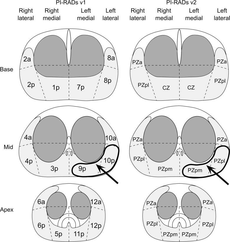 Figure 2b: