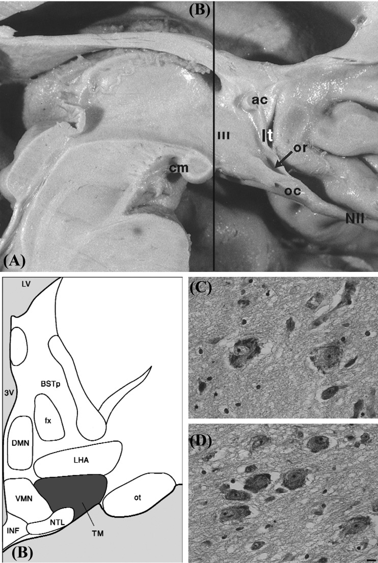 Fig. (1)