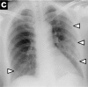 Figure 2c:
