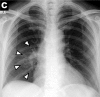 Figure 3c: