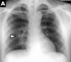 Figure 2a: