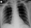 Figure 6b: