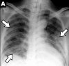 Figure 3a: