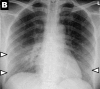 Figure 2b: