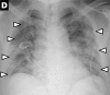 Figure 2d: