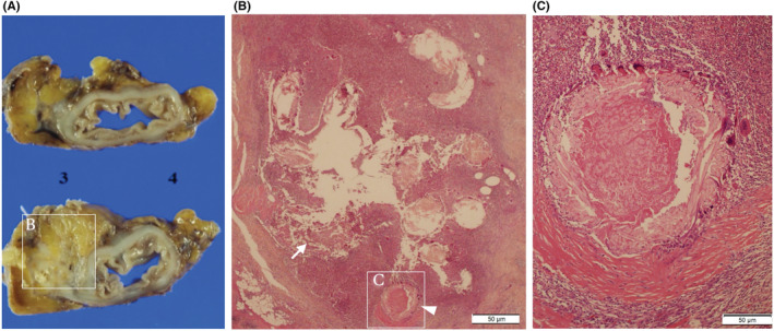 FIGURE 4