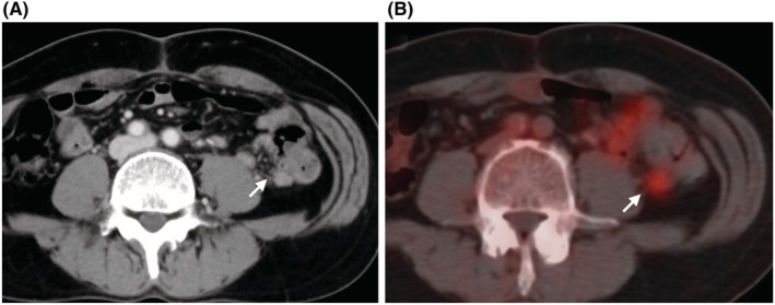 FIGURE 3