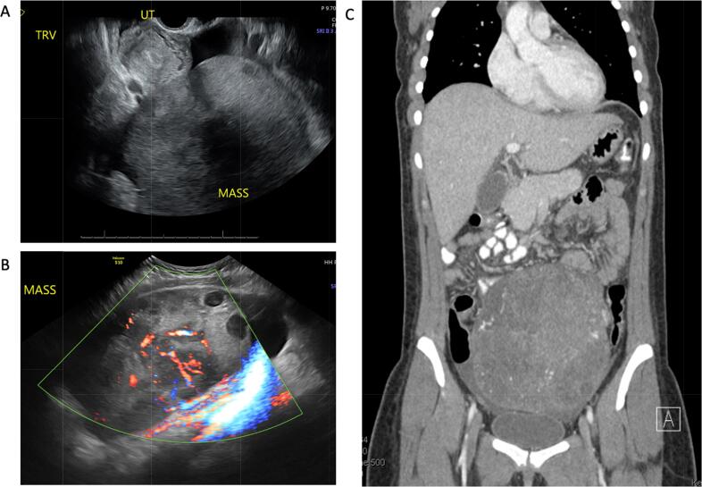 Fig. 1