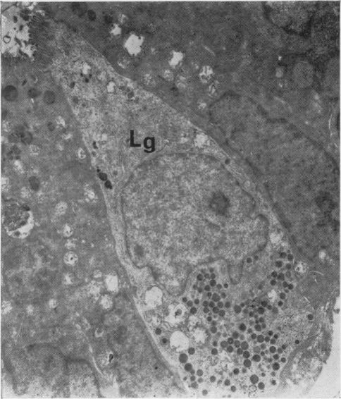 Fig. 16