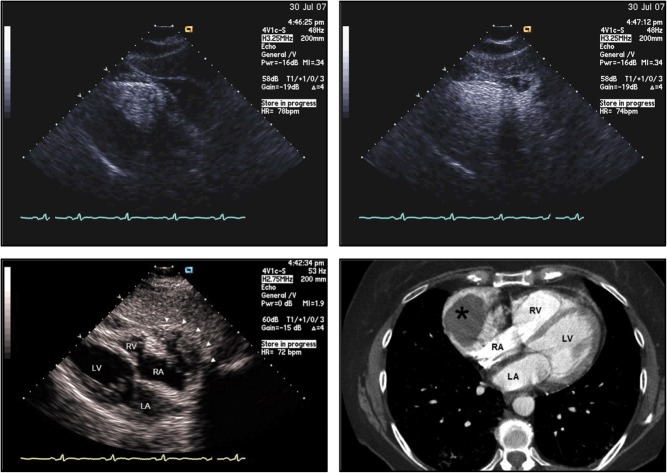 Figure 12