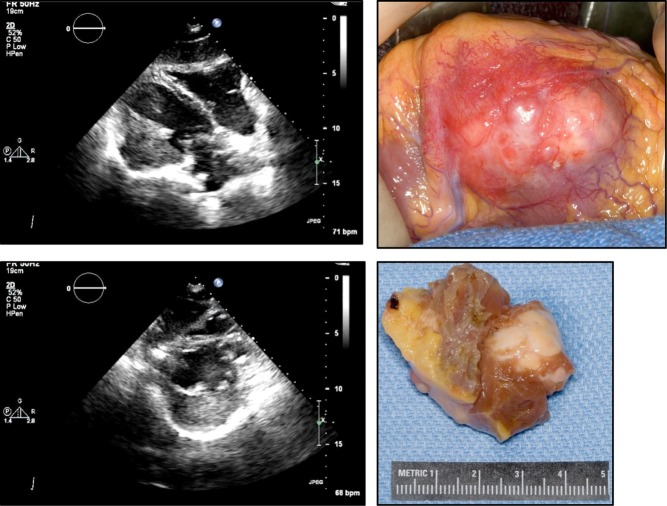 Figure 15