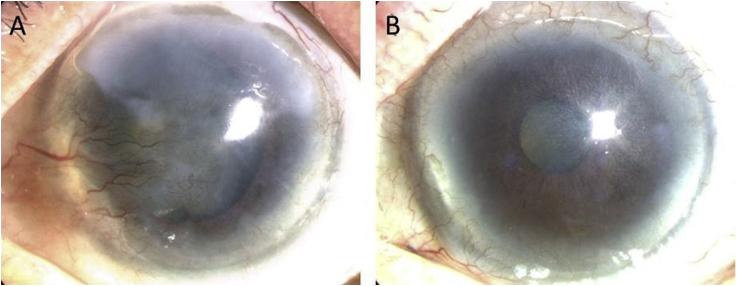 Fig. 4