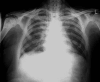 Fig 2.