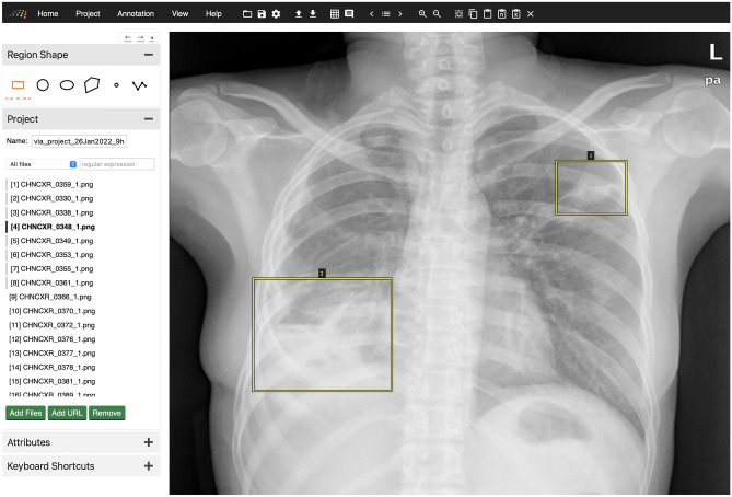 Fig. 4