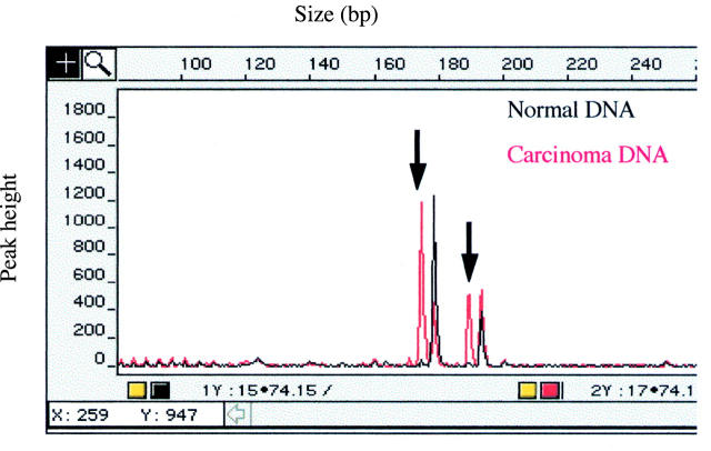 Figure 1  