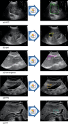 Fig 1