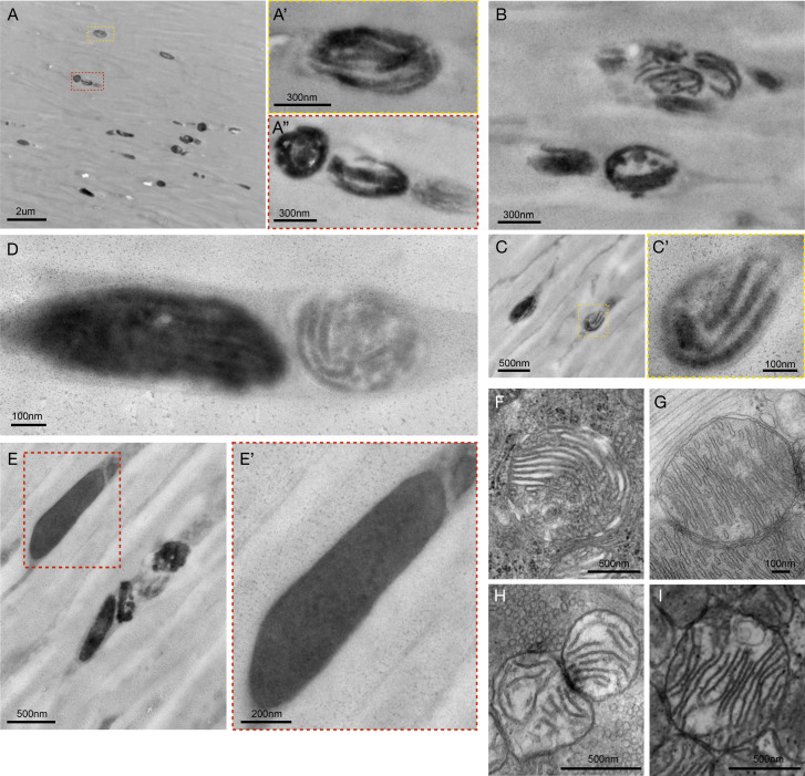 Figure 1—figure supplement 5.