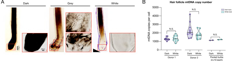 Figure 4—figure supplement 1.