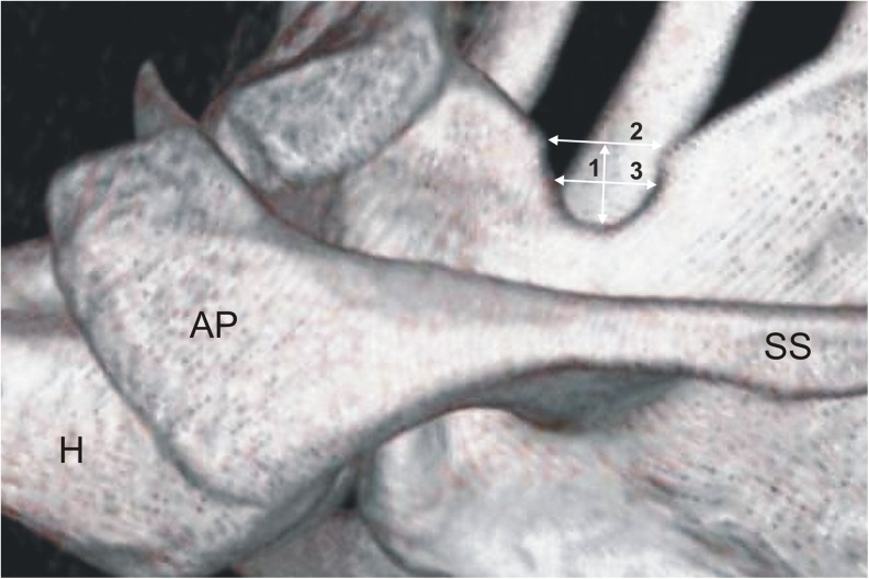 Fig. 1