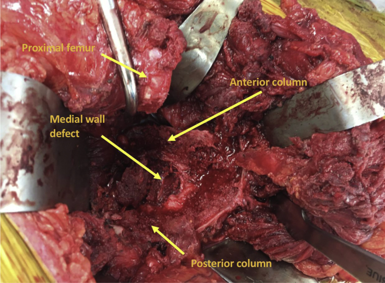 Figure 4