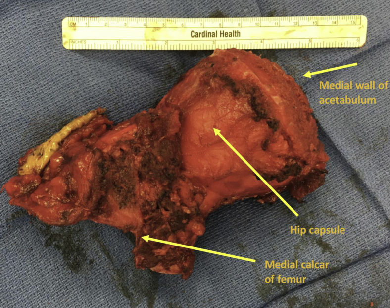 Figure 3